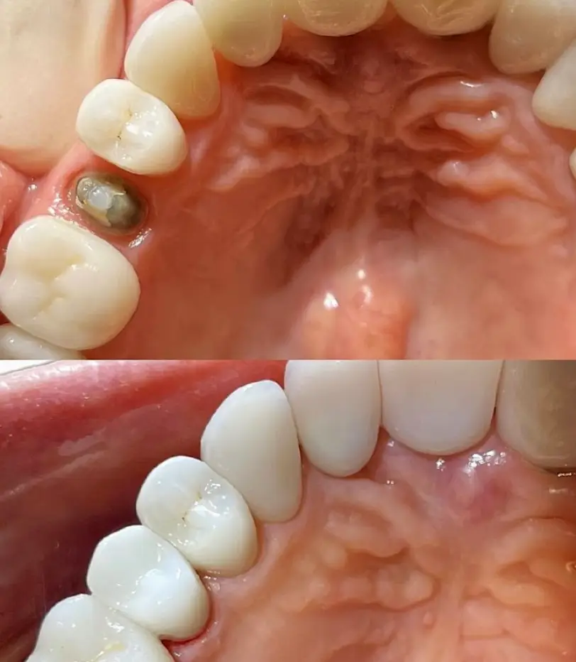Key Biscayne Family Dentistry, Dr. Jaime J. Vergara DDS