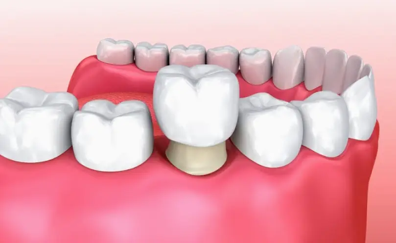 Family Dental Care of Marietta