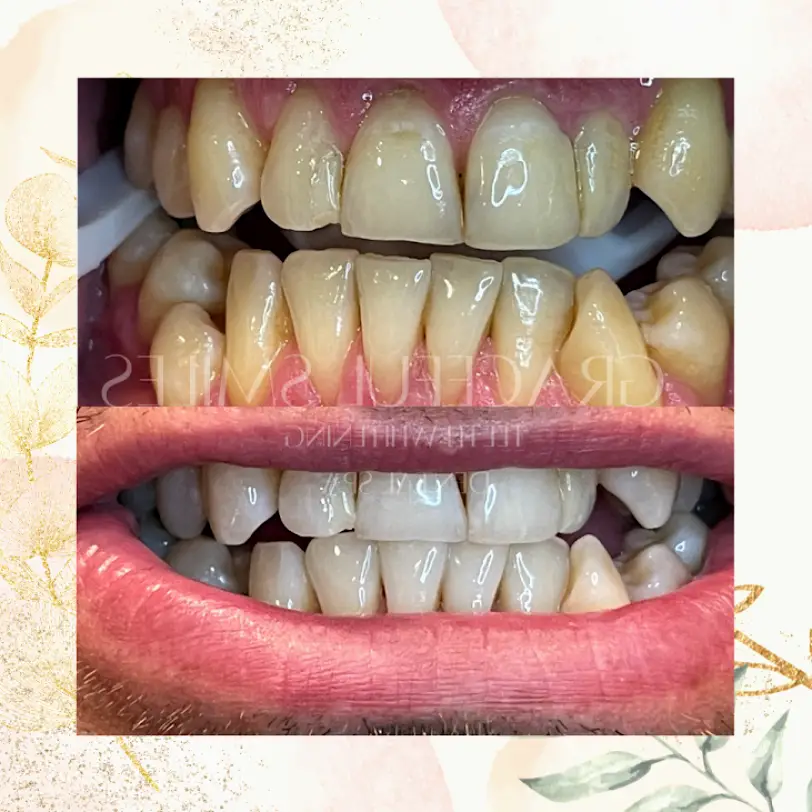 Port Royal Graceful Smiles Dental Spa