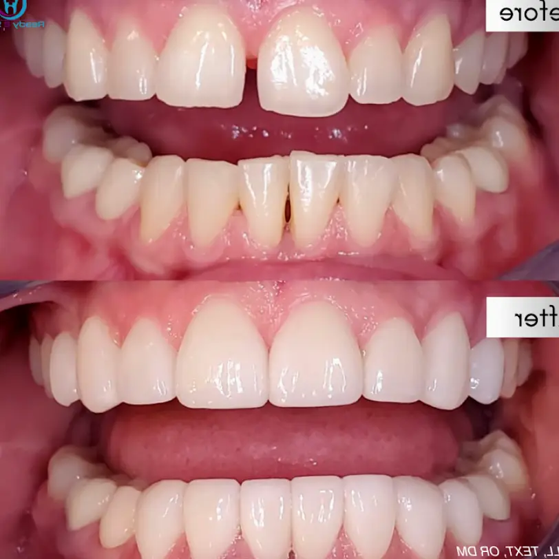 Temecula Ready 2 Smile Dental Group