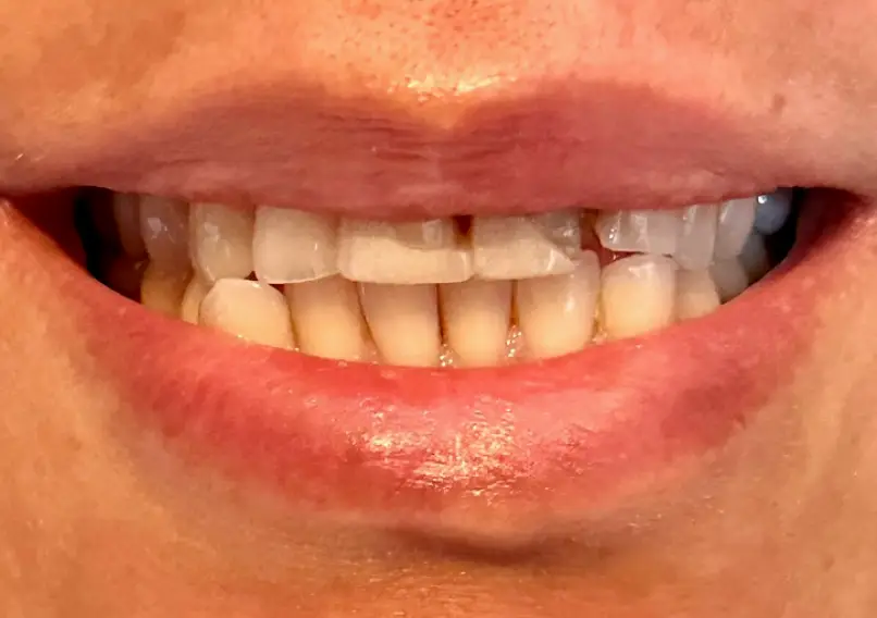 Downey Radiant Smiles Dentistry
