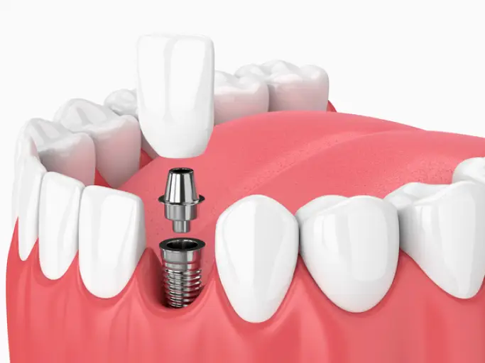  Las Vegas Nevada Dentistry & Braces