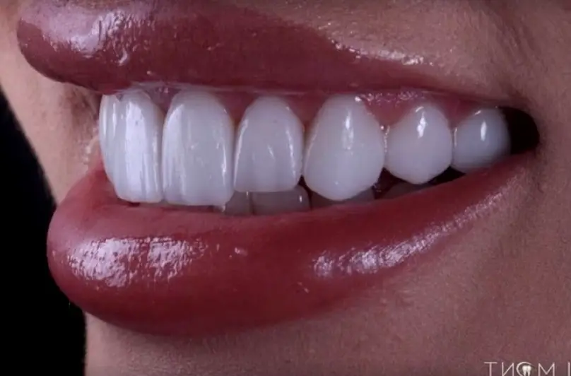 Tijuana Almont Dental