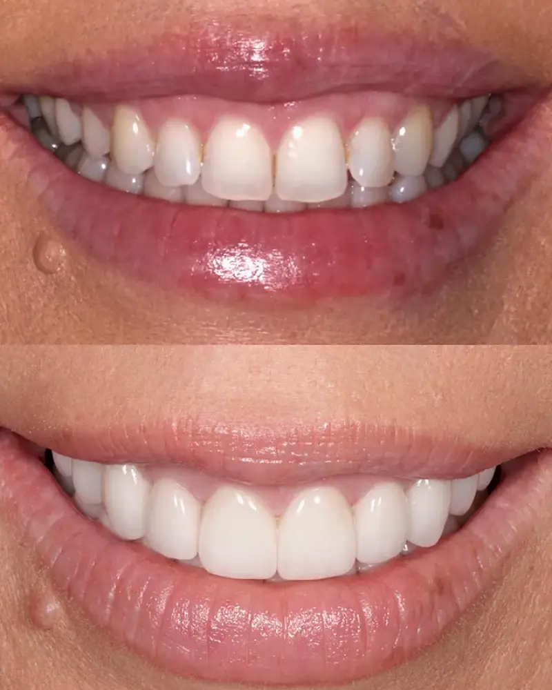 Peninsula Center of Cosmetic Dentistry Los Altos